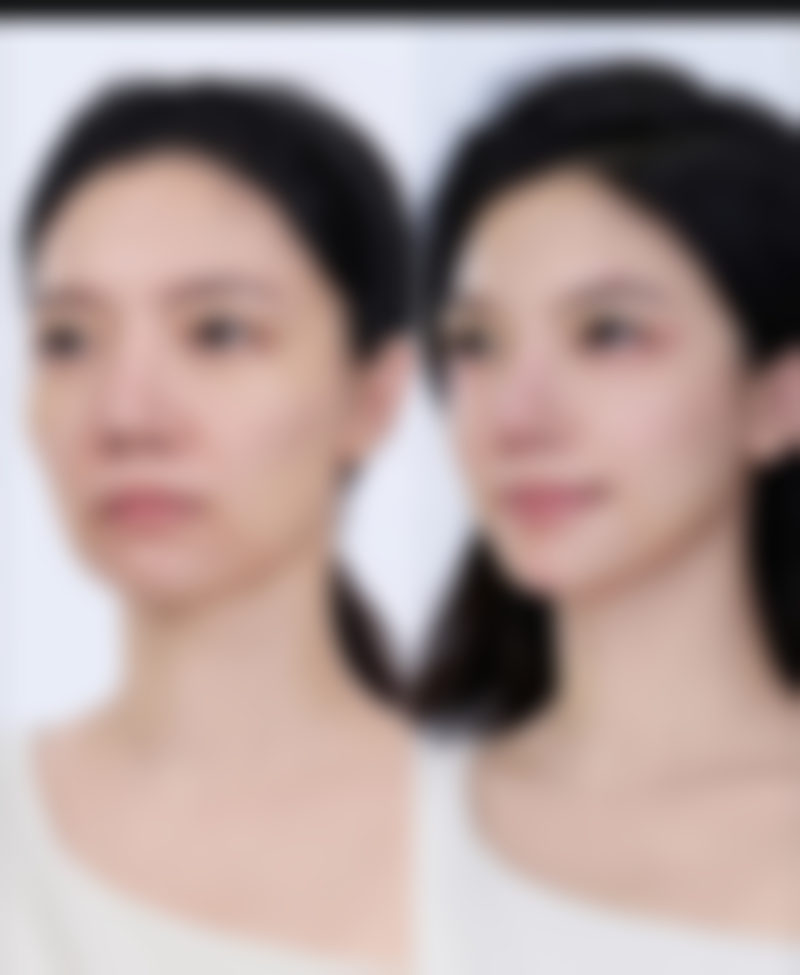 KIBBUM整形医院价格参考