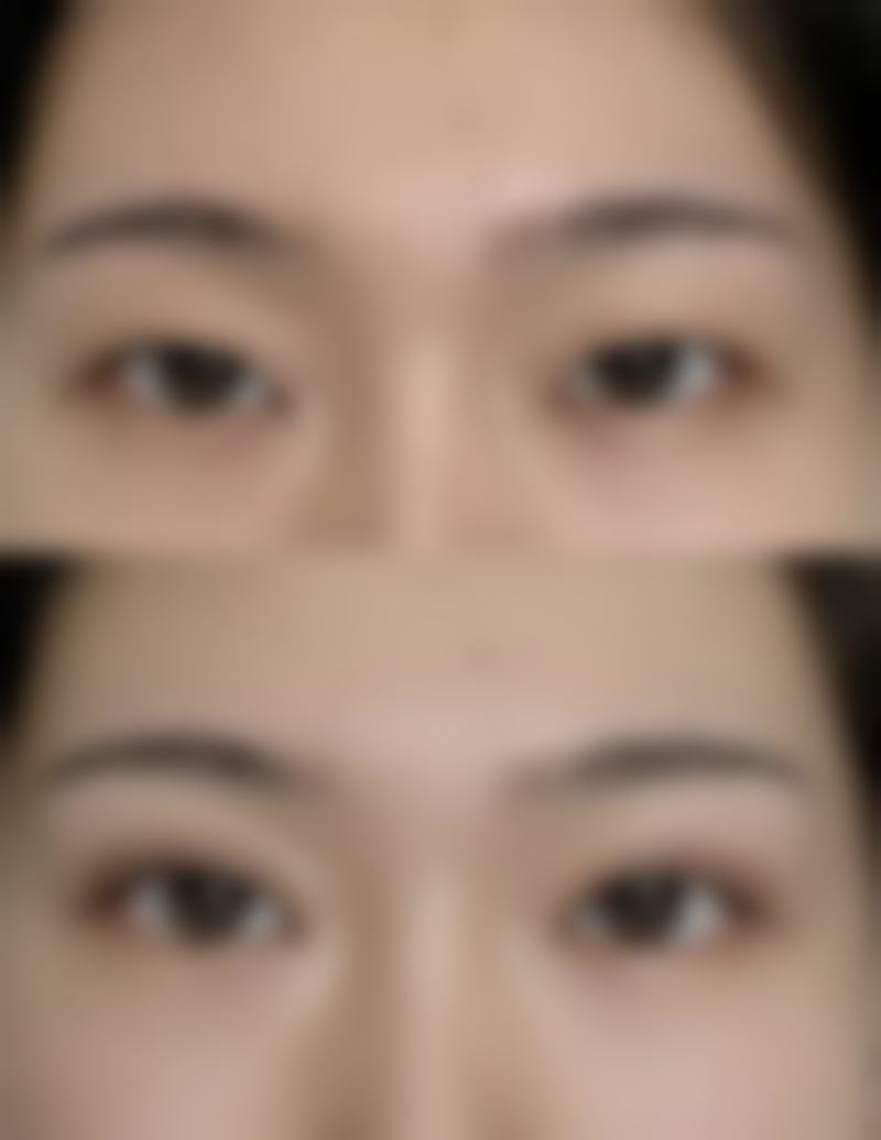 韩国BY整形外科正规资质