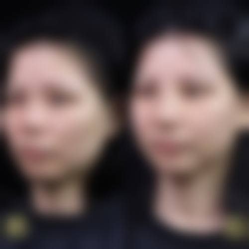 温州上雅医疗美容医院价格参考