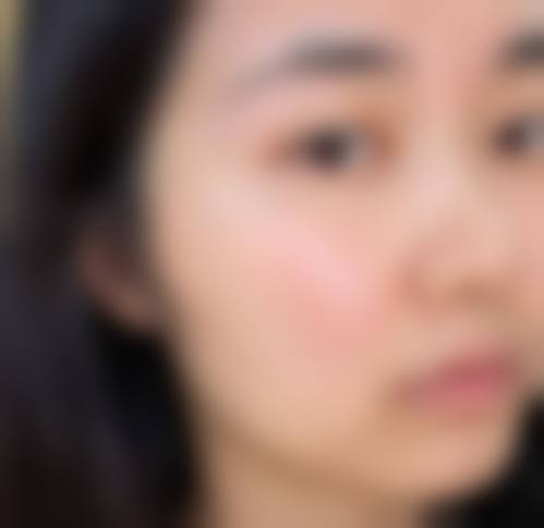 菏泽御美汇整形医院患者评价