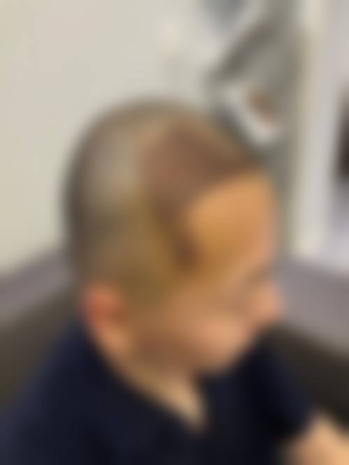 珠海微创外科医院价格参考