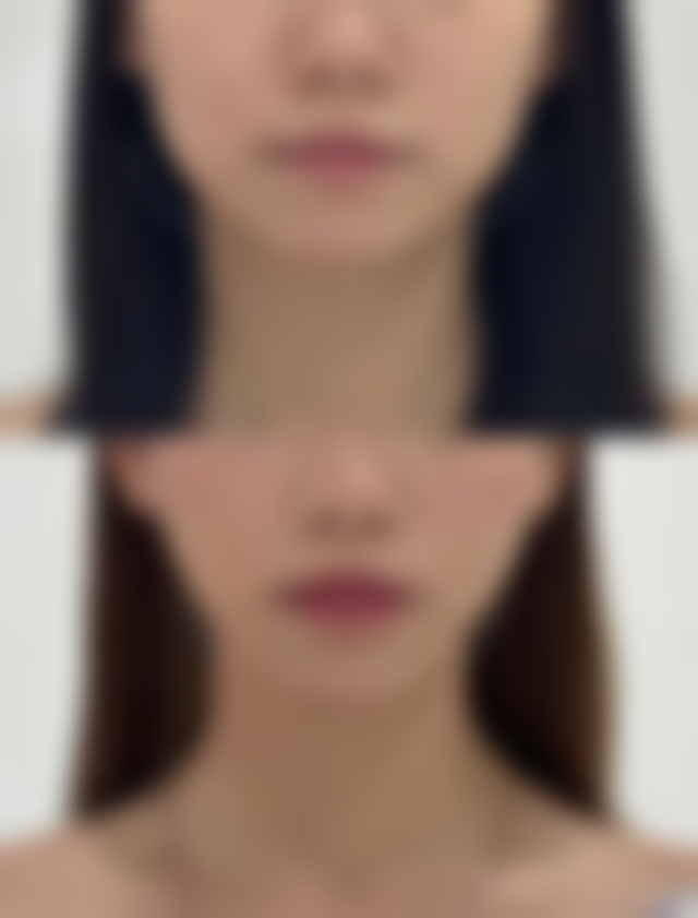 六安伊而美整形美容地址及到院路线