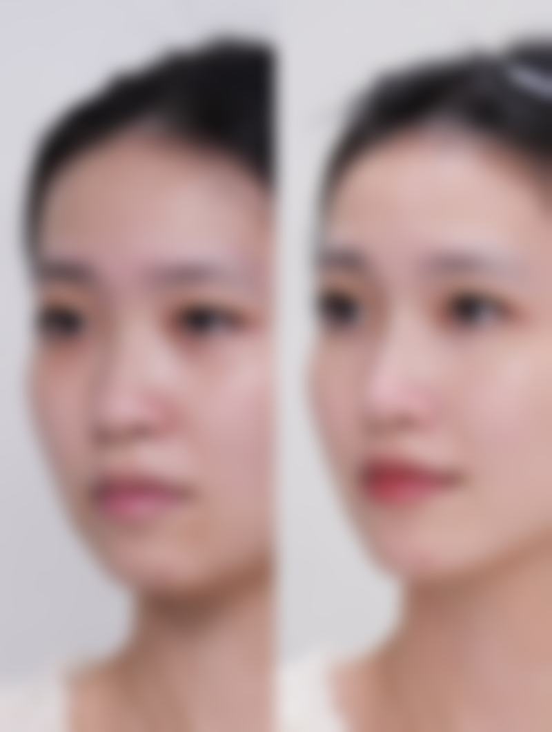 水庆亮擅长项目列表