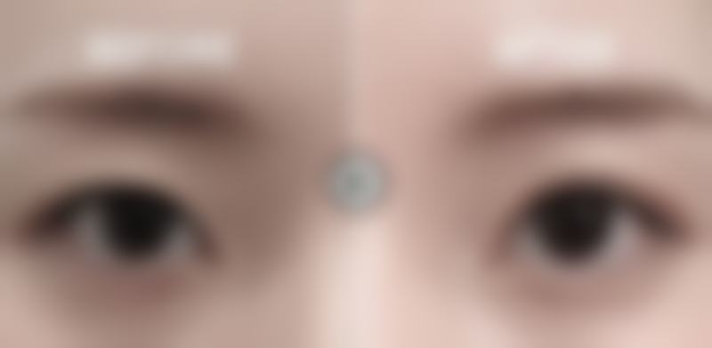 无锡明君医疗美容诊所患者评价