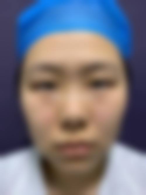 惠州圣瑞医疗美容门诊部患者评价