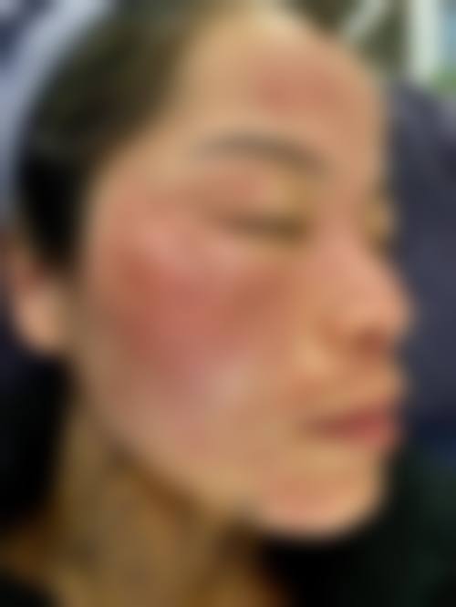 佐世保美肌诊所核心项目