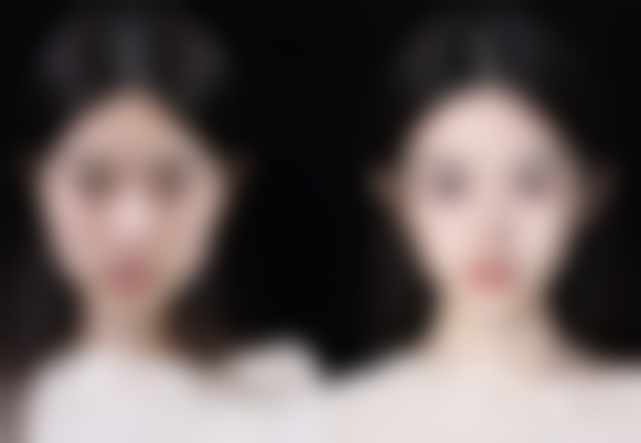 重庆嘉纯整形医院价格参考