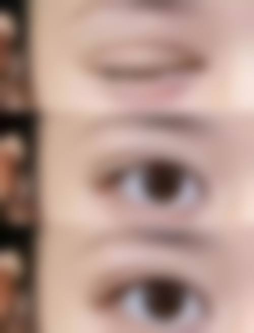 乌兰察布新世纪医疗美容诊所价格参考