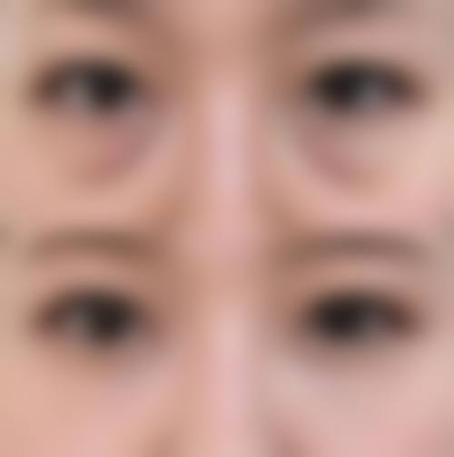 德惠高丽华医疗美容诊所患者反馈