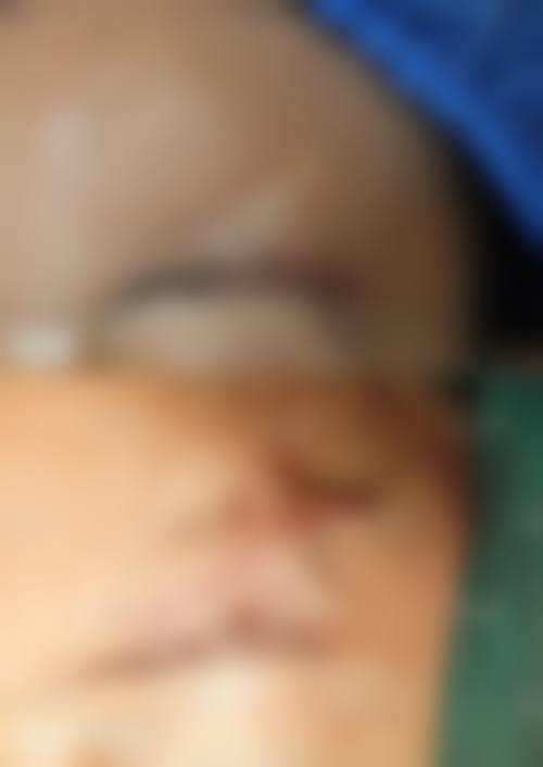 南宁四惠(馥方堂)医疗美容诊所核心项目