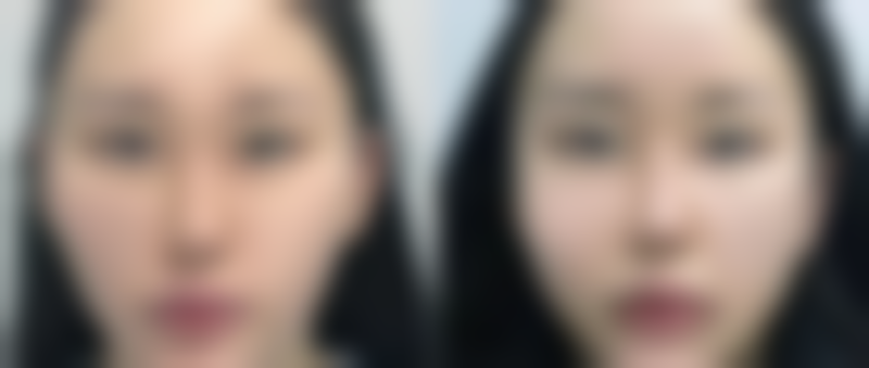 乌兰察布新世纪医疗美容诊所患者评价