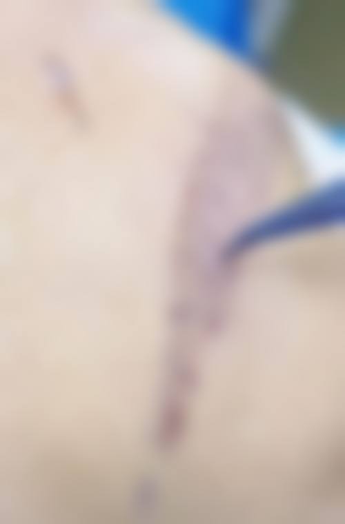 内蒙古乌兰察布韩雅医疗美容口腔医院核心项目