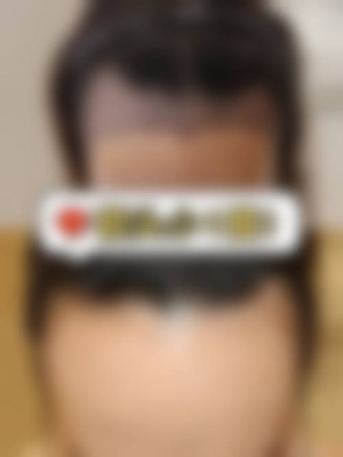 Hannacell皮肤科正规资质