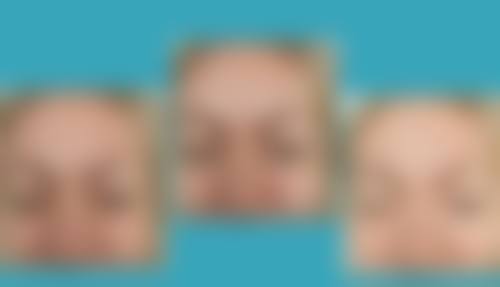 Hannacell皮肤科就诊反馈