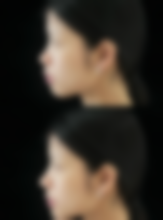 株洲雅美医疗美容核心项目