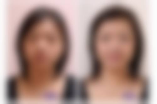 东莞百佳玛丽亚医疗美容医院求美者反馈