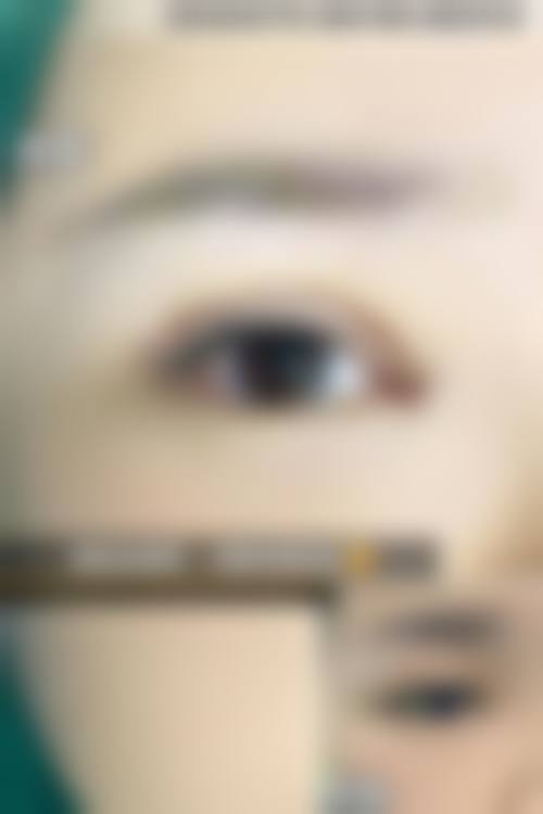 韩国YEJUNG HOLIC整形外科核心项目