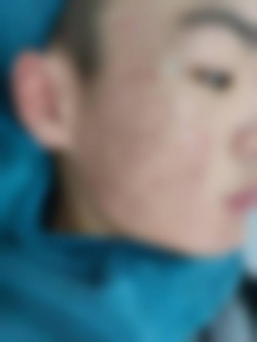 西安灵韵天鹅医疗美容门诊部患者评价