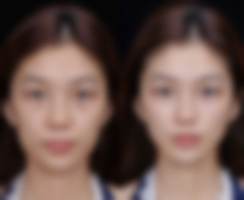 东莞百佳玛丽亚医疗美容医院核心项目