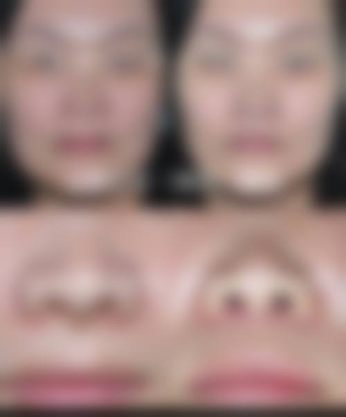 王月明患者评价