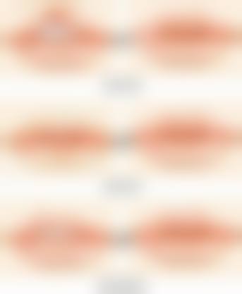 2026 遵化金荣整形医院价格参考