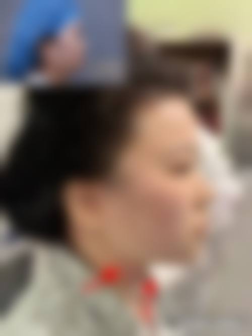 南京月亮鱼整形医院患者评价