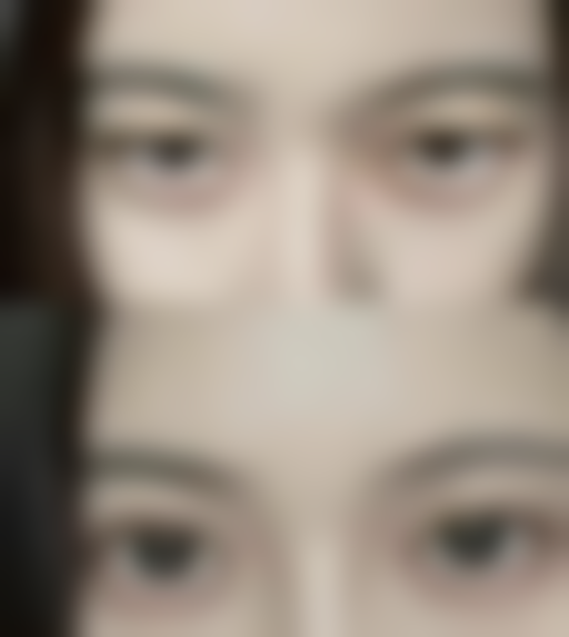 金华张小红医疗整形美容核心项目