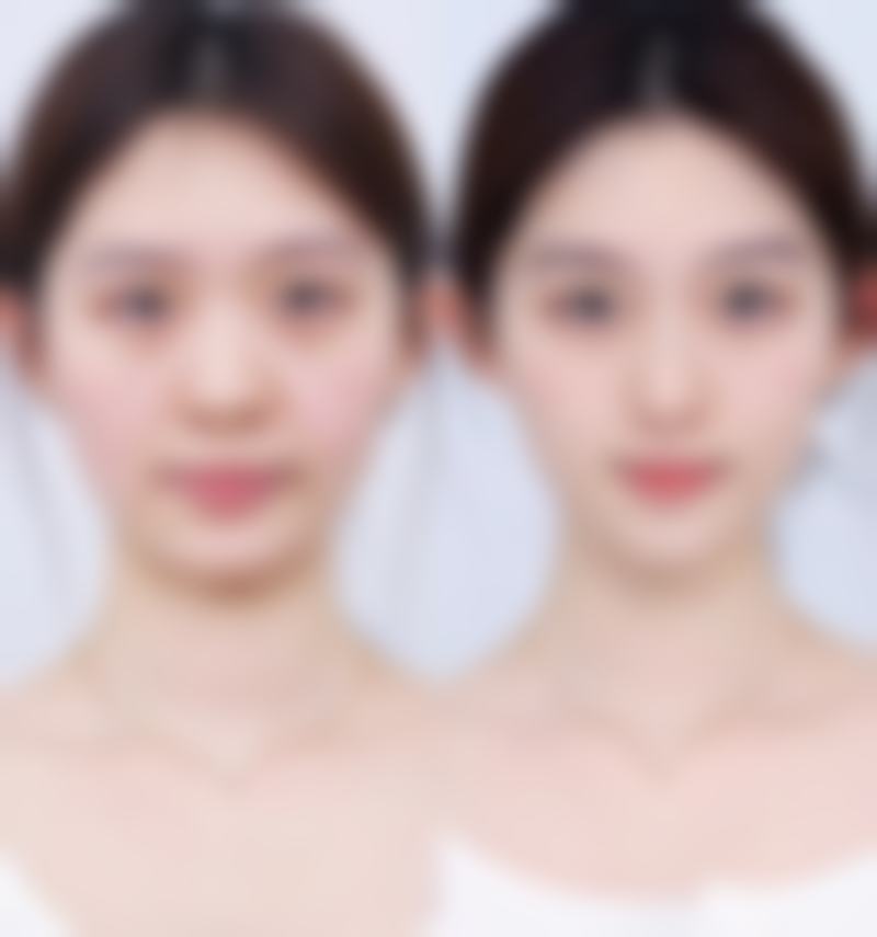 金华张小红医疗整形美容交通路线及预约