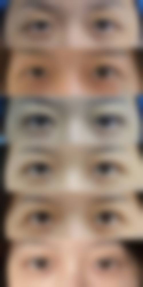 韩国Onecell皮肤科患者评价