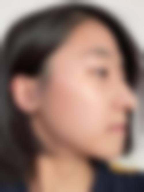 崇州丽百颜整形美容外科诊所患者评价