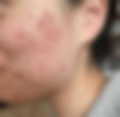 2026 韩国Onecell皮肤科价格参考