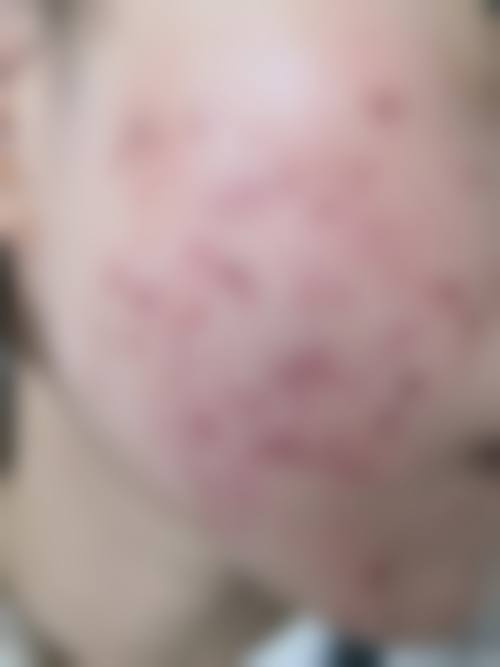 韩国Onecell皮肤科医生团队