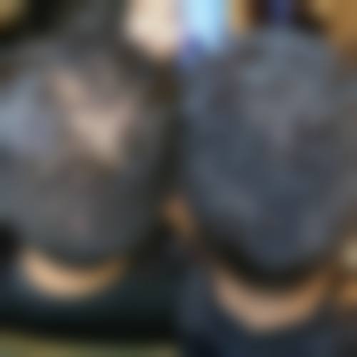 2026 贵阳新生植发医院价格参考