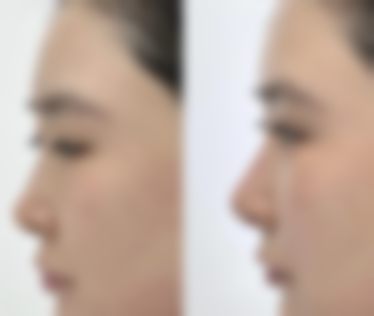 王广东擅长项目列表