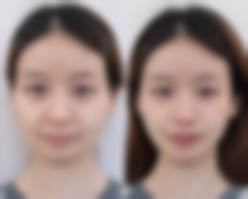 天津斯坦姆医院医疗美容科核心项目