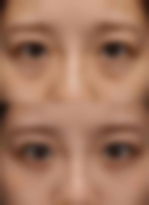 青岛安娜臻美整形医院患者评价