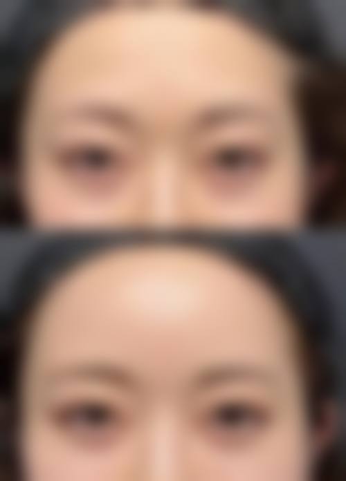 青岛安娜臻美整形医院核心项目