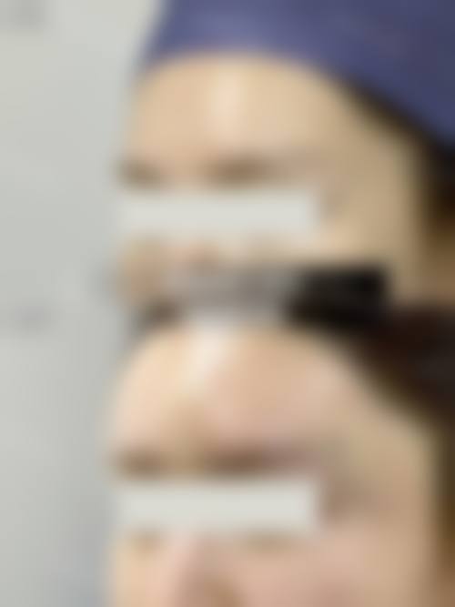 2026 深圳市东芳韵美整形医疗门诊部价格参考