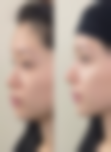 2026北京玉之光医疗美容门诊部价格参考