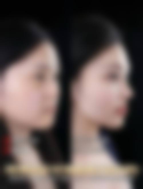 许昌博爱医院医疗美容整形科交通路线及预约