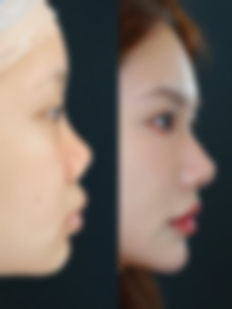 大同时序悦己医疗美容诊所核心项目