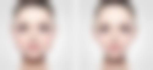 南京韩辰美容医院患者评价