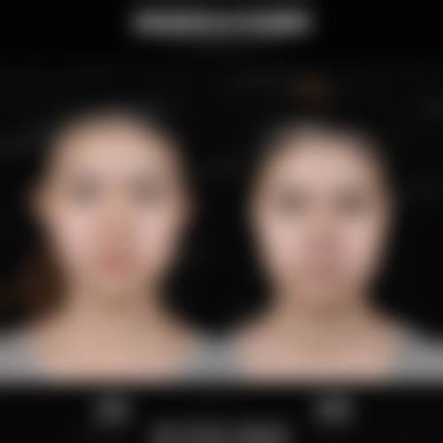 深圳蜜柚医疗美容诊所核心项目