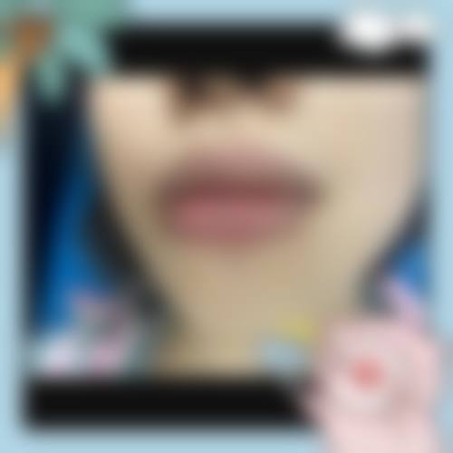 合肥佳壹美整形医院核心项目