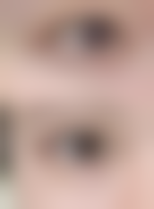 2026 洛阳毛大夫美莱纯韩整形医院价格参考