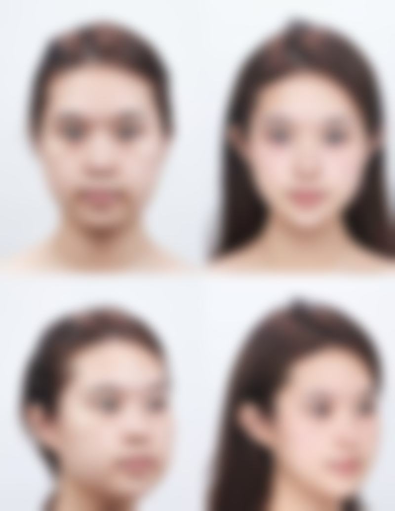 成都度曼美整形医疗美容医院患者评价