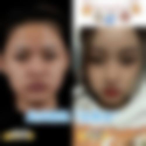 2026 西宁伊美莱医疗整形美容门诊部价格参考