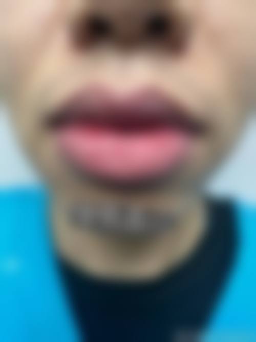 北京长虹医院整形科核心项目