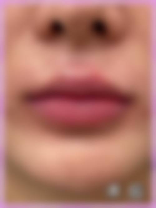 北京长虹医院整形科价格参考