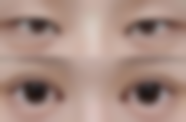 西宁伊美莱医疗整形美容门诊部核心项目